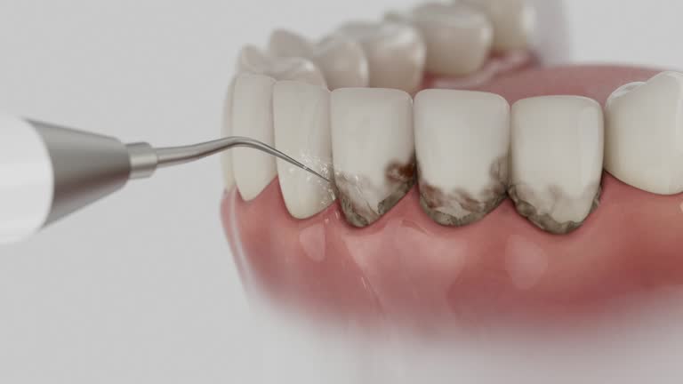 Reliable Dental Implants contractor in Town Line, NY by Smile Center Dentistry